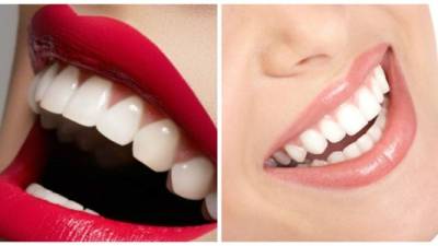 Con estos consejos podrás obtener una dentadura blanca sin necesidad de gastar.