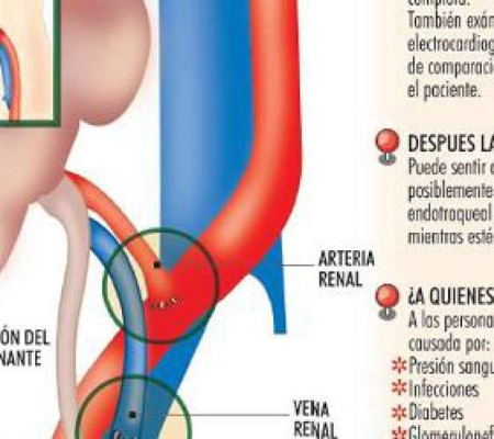 Harán trasplante de riñón en la ciudad