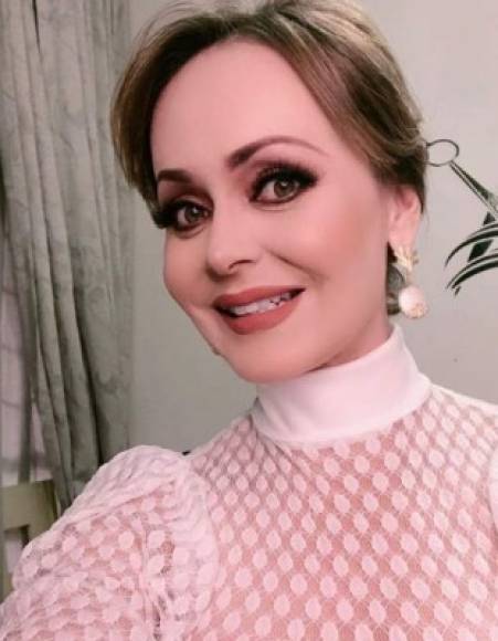 A sus 45 años de edad, el rostro de Gabriela Spanic luce totalmente distinto. Por supuesto, los años cobran factura, pero los retoques en sus pómulos, labios y otras facciones son evidentes.