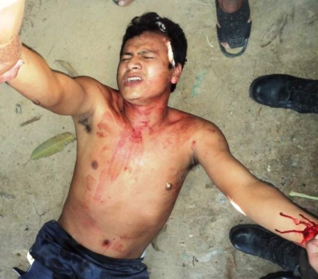 Hombre 'poseído' se extirpa testículo en iglesia evangélica