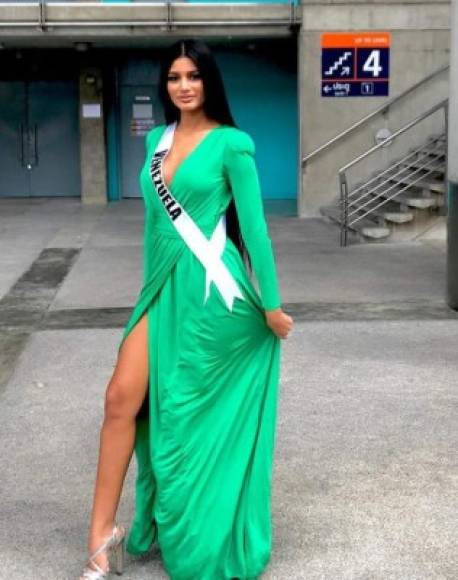 Ahora que Miss Venezuela 2017 cautivó el ojo del público, fotos antiguas de la beldad resurgen para poner en duda si toda su belleza es 100% autentica.