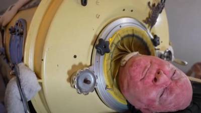 Paul Alexander falleció a causa de covid tras pasar varias décadas en un “pulmón de hierro”.