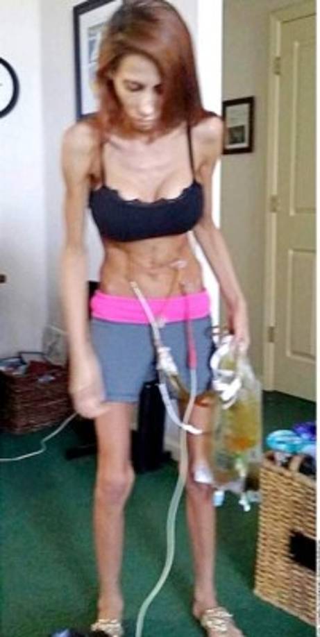 Aparte de esto, le insertaron clavos de titanio para sostener sus vértebras. <br/>Según los médicos, sus probabilidades de sobrevivir eran tan solo de un 8%.<br/><br/>'Nunca había experimentado algo tan horrible como que un grupo de doctores entrarán en mi cuarto para decirme que ya no había nada más que hacer y que te prepararás para lo peor'.