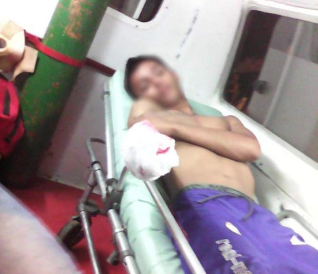 Llegan los primeros quemados por pólvora al Mario Rivas