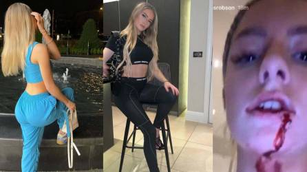 Escándalo en Inglaterra. La bella influencer Harriet Robson ha denunciado con pruebas la violencia de género que ha recibido por parte de futbolista del Manchester United.