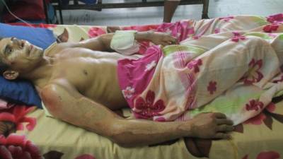 Adán Ríos permanece en observación en el hospital Mario Rivas desde el martes.