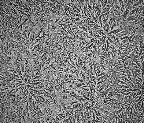 Ver lágrimas con un microscopio revela increíbles hechos