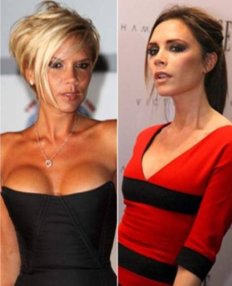 Otras como Victoria Beckham se sometieron a una reducción pero para remover sus implantes. <a href='https://www.laprensa.hn/fotogalerias/farandula/1391783-411/chrissy-teigen-muestra-figura-tras-remover-implantes-senos-silicona' style='color:red;text-decoration:underline' target='_blank'>MIRA: Chrissy Teigen muestra su figura tras remover sus implantes de senos</a>