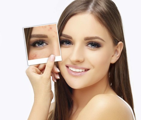 Nuevo tratamiento antiedad