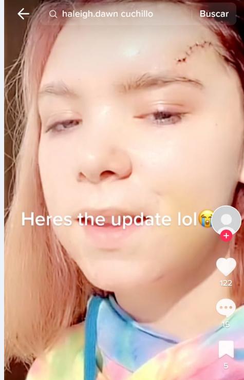 La joven subió otro video mostrando sus puntadas.