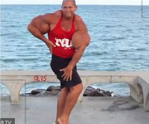 Video: Inyecta en sus brazos aceite y alcohol para lograr una musculatura récord