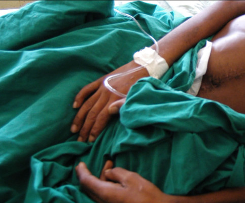 Joven hondureño sufre por una erección que lleva cuatro días