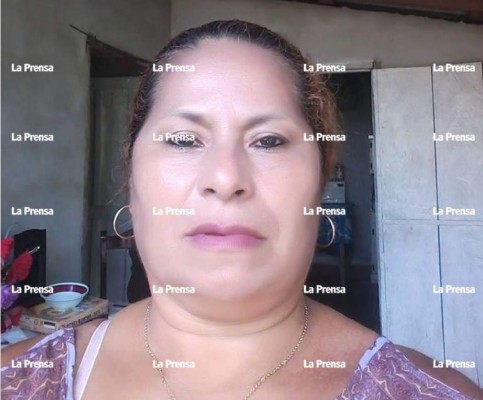 Tres muertos y varios heridos deja múltiple colisión en peaje de Santa Cruz de Yojoa