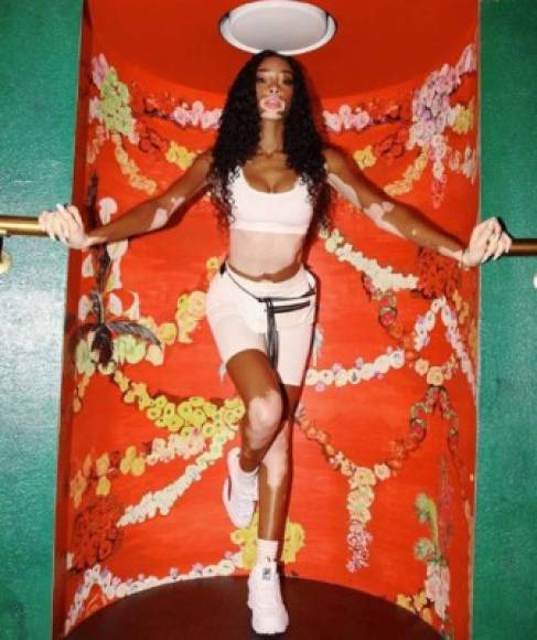 Winnie Harlow, la modelo con vertiligo que desfilará en el Victoria's Secret Fashion Show 2018 que realizará nuevamente en New York.<br/>