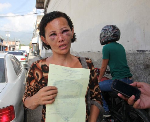 Hondureña recibe brutal golpiza por no pagar deuda