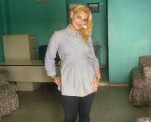 Hondureña golpeada por su pareja sale del hospital