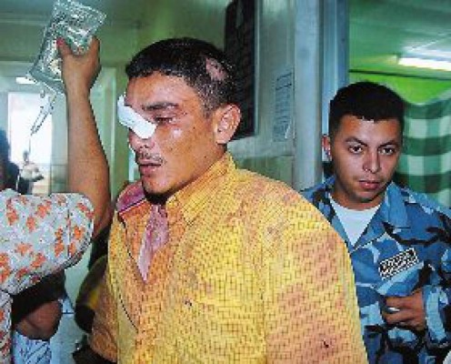 Vecinos enardecidos envían a un ladrón al hospital