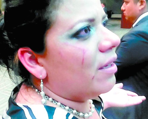 Diputada liberal denuncia que esposa de David Romero la agredió