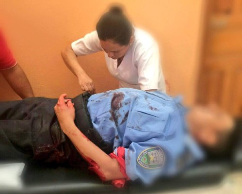 Capturan a segundo sospechoso por atentado contra policías