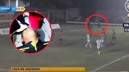 El árbitro asistente Jimmy Carranza fue agredido por un aficionado en el partido Real Juventud-Olimpia Occidental en el estadio Argelio Sabillón de Santa Bárbara.