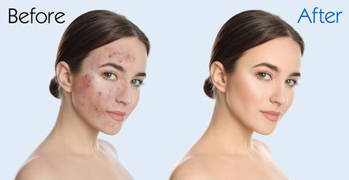 La exfoliación regular deja la piel más suave y con un brillo natural.