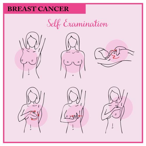 El autoexamen es un método para detectar bultos en la mama.