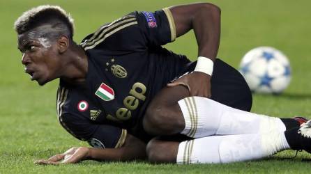 El centrocampista francés de la Juventus, Paul Pogba, se lesionó durante la pretemporada.
