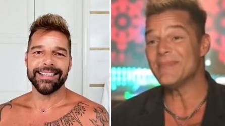 El cantante puertorriqueño Ricky Martin aseguró este fin de semana que no se ha hecho retoques faciales y atribuyó el cambio que muchos vieron en su rostro a un suero de multivitaminas, del que no dio más detalles.