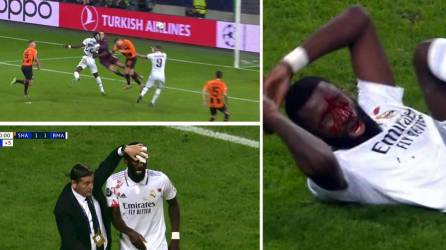 Antonio Rüdiger se llevó un tremendo golpe y corte en su rostro tras marcar el gol del empate del Real Madrid contra el Shakhtar Donetsk.