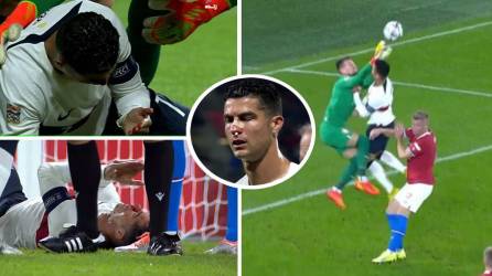 Cristiano Ronaldo sufrió un fuerte golpe en el rostro y terminó sangrando en el juego República Checa-Portugal.
