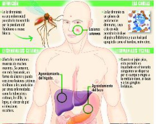 Temor por leishmaniasis en zona de El Merendón