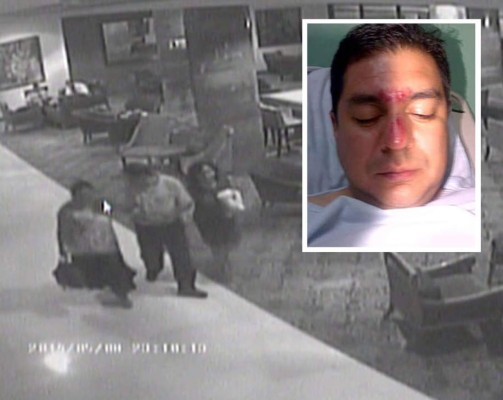 Honduras: Policía difunde videos donde director de Casa Alianza choca contra motorizada  