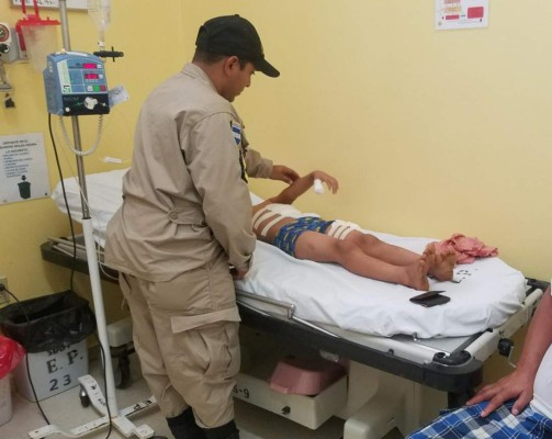 Dos menores de 9 y 12 años resultan quemados por cohetes en Olancho