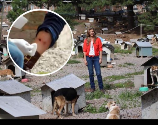 Perro muerde a Montserrat Oliver