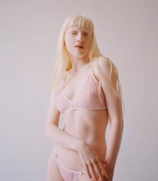 Anastasia Zhidkova es una albina de Rusia, ha causado sensación en este país por rareza e imágenes androides.