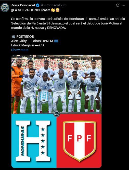 Esto dicen tras primera convocatoria de Molina y Otero deja polémica reacción