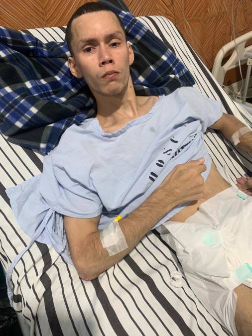 Cuatro días después de abandonar el hospital de La Ceiba tuvo otra recaída y lo volvieron a conectar al respirador artificial.