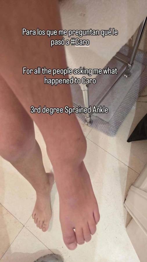 Hija de Jacky Bracamontes sufre terrible accidente en la escuela