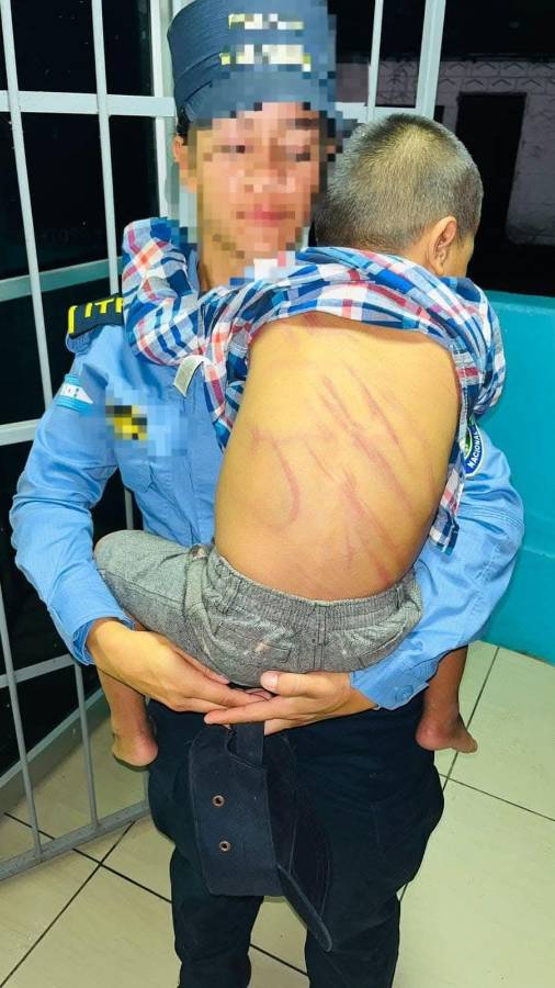 El niño de 4 años recibió severos golpes en la espalada, propinados con una faja, además en otras partes del cuerpo con pies y manos.