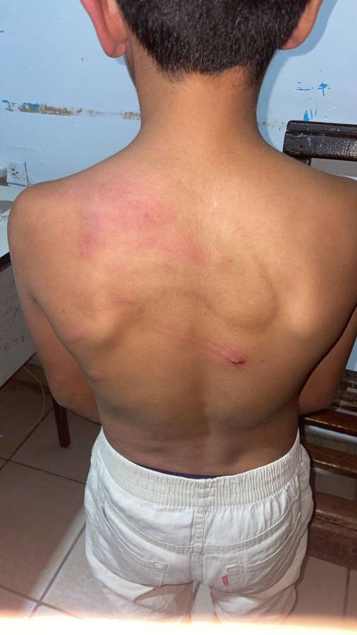 El menor fue evaluado en una clínica de La Entrada