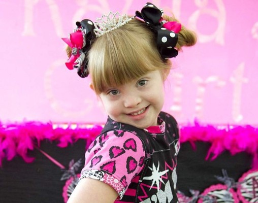 Hermosa modelo con síndrome de Down