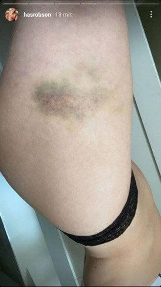 La influencer británica mostró un gran número de fotografías, vídeos y notas de voz en las que muestra sus pruebas sobre la violencia de género que ha sufrido por parte del joven profesional del Manchester United. 