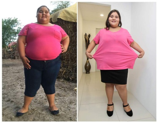Menor mexicana baja 90 kilos y se prepara para celebrar sus 15 años