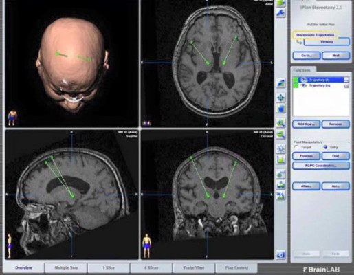Hospital Escuela gana donación de moderno equipo médico 'neuronavegador'