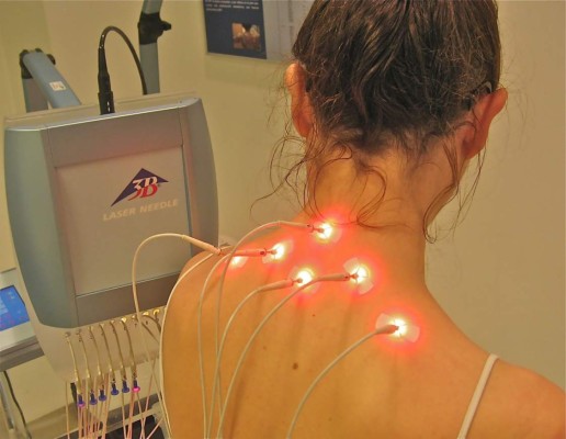 Acupuntura láser: Tecnología y tradición combinadas