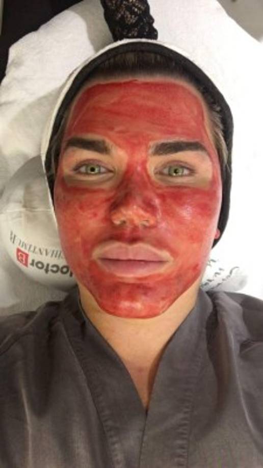 En mayo pasado incluso quiso cambiar el color de sus ojos, pero los médicos de Nueva Delhi, en la India, se negaron a realizar la cirugía porque sus ojos resultaron ser demasiado pequeños para sostener un iris artificial. A pesar de su tristeza, Alves agradeció que los expertos tomaran en serio la seguridad de sus pacientes.<br/>