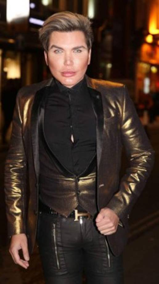 Rodrigo Alves, mejor conocido a nivel mundial como el 'Ken humano', se ha sometido durante años a diversas cirugías plásticas para transformar su apariencia. Su objetivo siempre ha sido obtener el rostro perfecto, y para conseguirlo, ha invertido miles de dólares.
