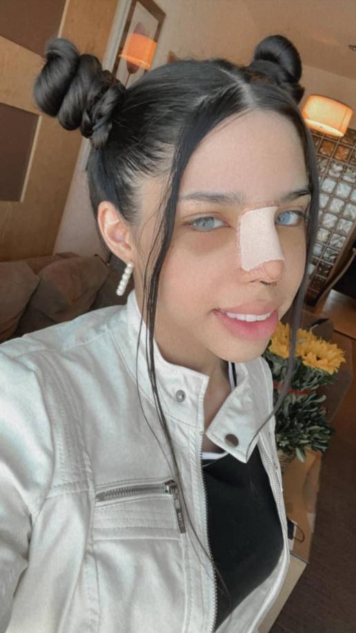 Yeri Mua se ha sometido a varias cirugías para transformar su cuerpo y cara, una de ellas fue liposucción con transferencia de grasa a glúteos y aumento de senos.