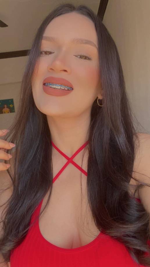 Al ventilar el lugar y, seguir el protocolo, descubrieron el cuerpo de la mujer sobre la cama.