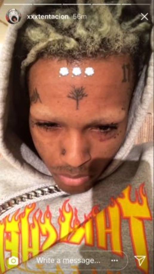 7- Más problemas con la ley<br/><br/>Además de los 15 cargos por agresión agravada de una mujer embarazada y violencia doméstica ocurrió en 2016 (con su novia Geneva Ayala). <br/><br/>El rapero volvió a caer en problemas con la ley en 2016, cuando fue arrestado por robo de viviendas, en marzo de 2017 se declaró inocente y recibió libertad condicional, según los registros judiciales.<br/><br/><br/>Sus problemas llevaron a Spotify a quitar su música hasta que retrocedieron al recibir críticas por parte de artistas como Kendrick Lamar.<br/><br/>